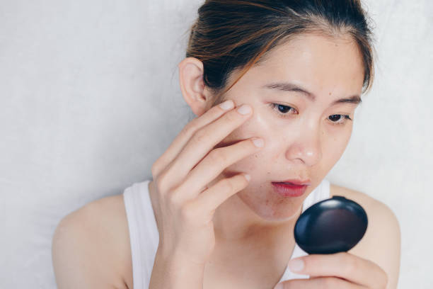 Complete Guide to Skincare Routine for Oily Skin