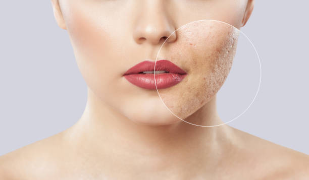 Scar Coverage Tips: Science-Backed solutions for Flawless Skin