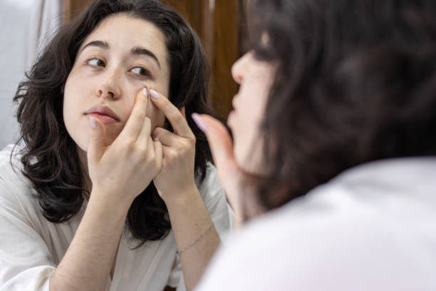 Skin Changes During Your Period: Causes & Skincare Tips