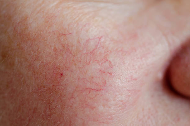Sensitive Skin Care: Best Products & Remedies for Healthy Skin