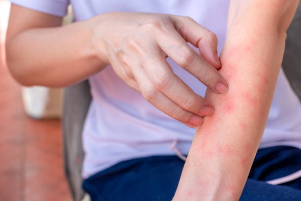 Skin Rash: Causes, Types & Dermatologist-Approved Remedies