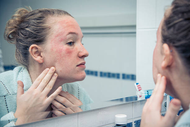 Sensitive Skin Care: Ultimate Guide to Tips, Products & Routines