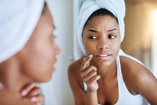 7 Steps to Treat Chemical Burn on Face Safely & Effectively