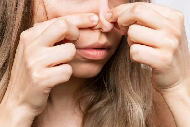 How to Get Rid of Blackheads at Home