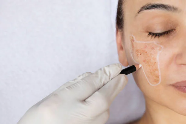 Top Brightening & Pigmentation-Targeting Products