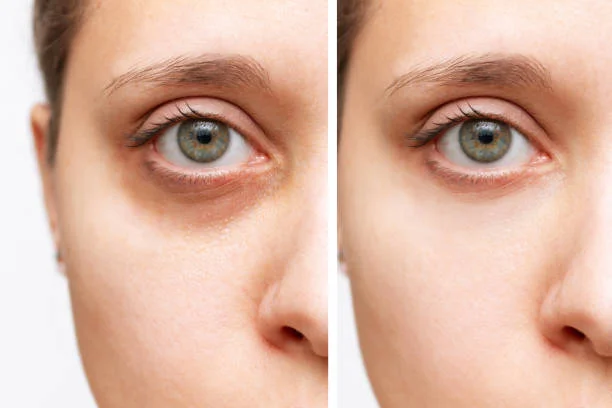 Best Eye Cream for Dark Circles: 15 Top Picks (UK & USA | 2025)